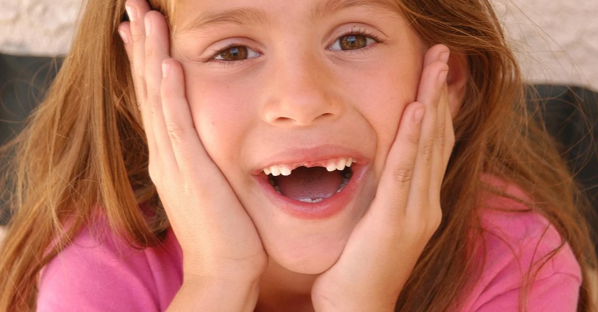 Close-up of a child with an open mouth showing dental misalignment